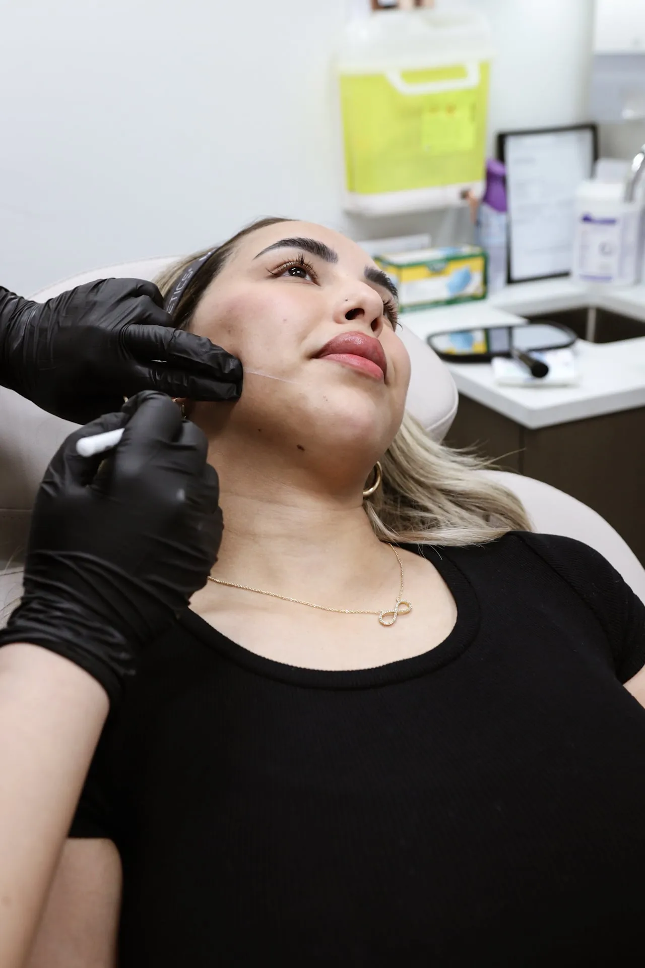 A clinician maps a patient’s jawline before dermal filler treatment