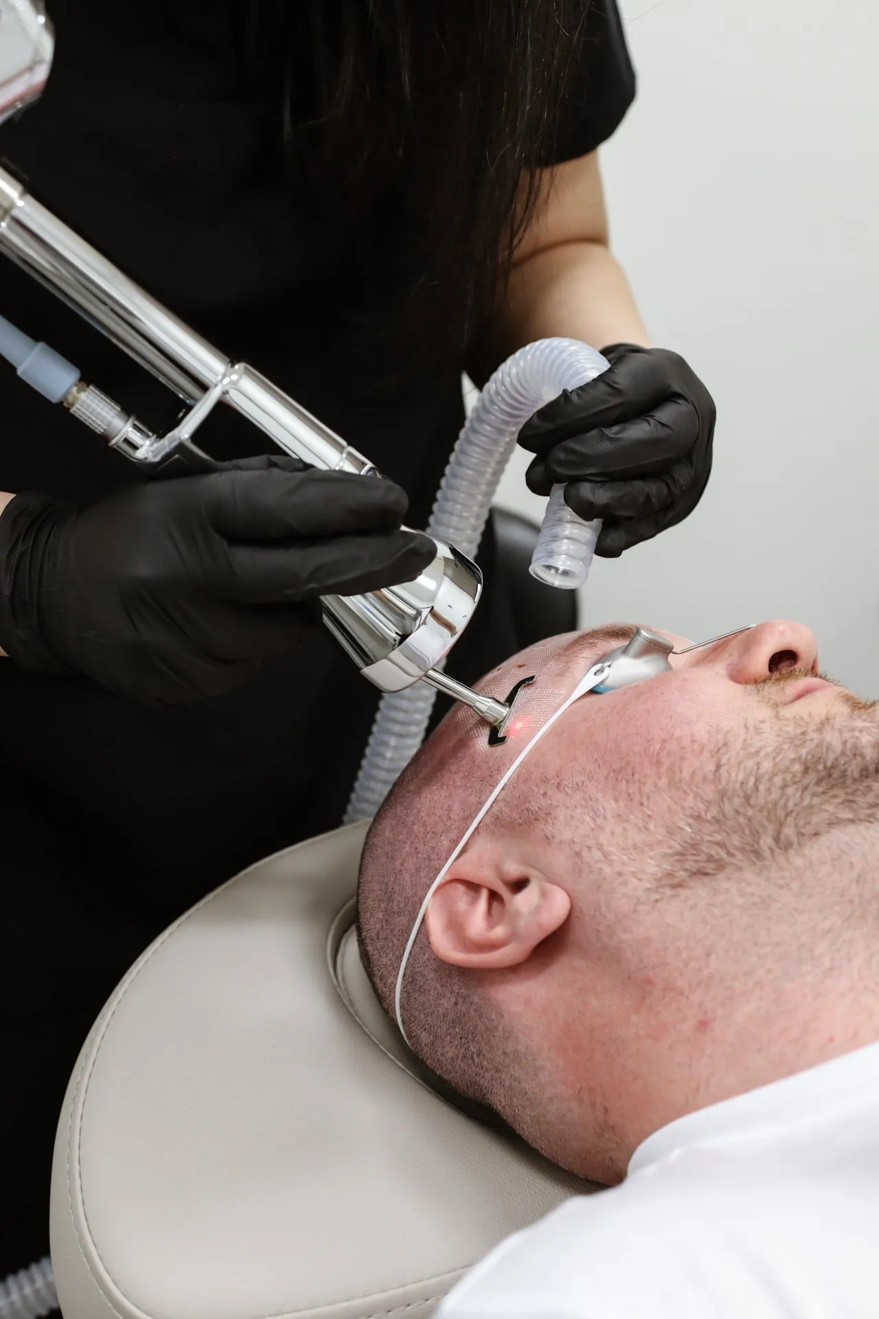 A clinician performs a laser peel on a patient’s forehead